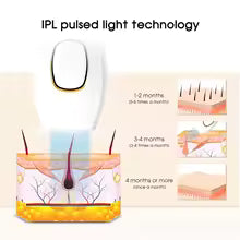 Depiladora IPL Magic